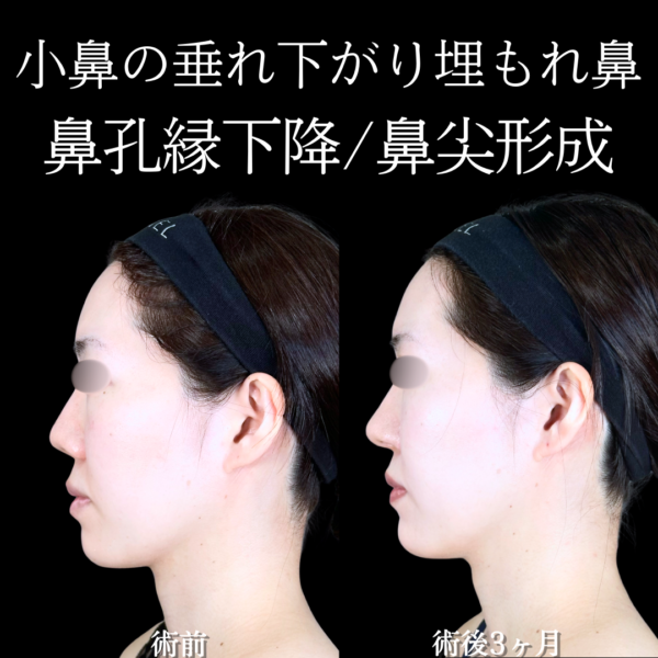 No.20181の症例写真