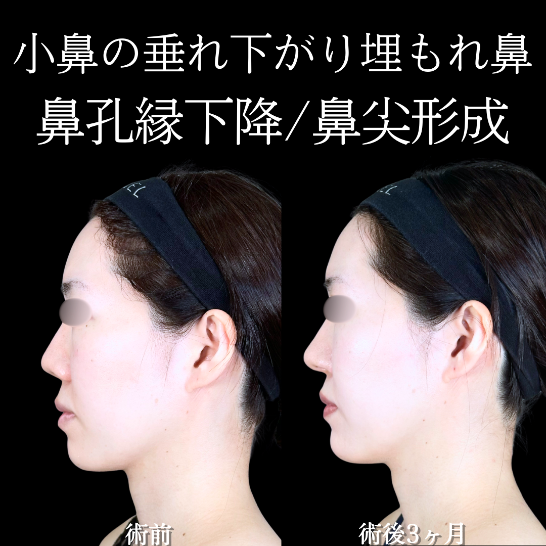 No.20181の症例写真