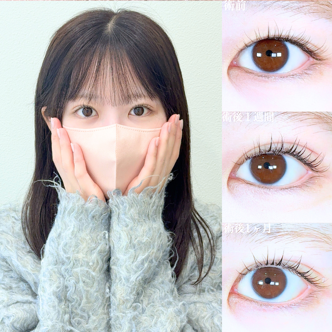 No.20194の症例写真