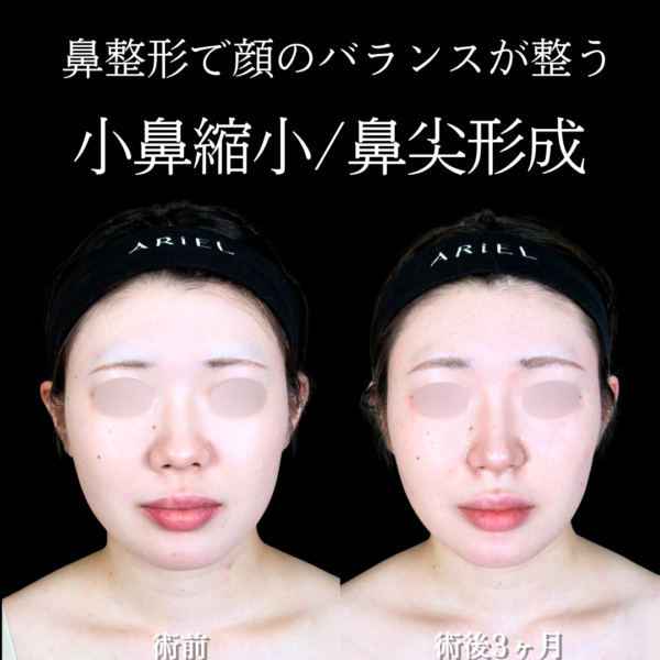 No.20200の症例写真