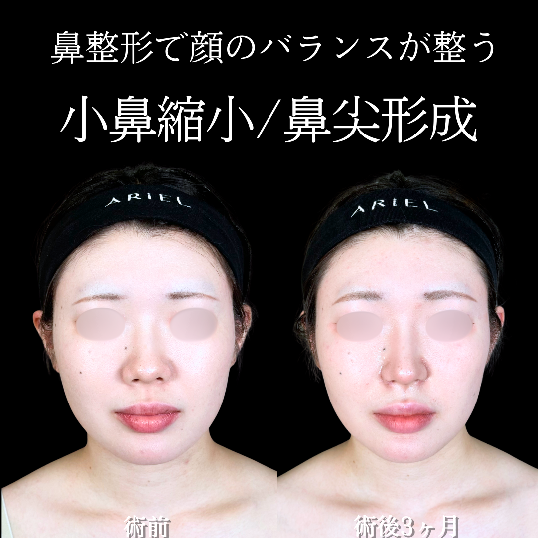 No.20200の症例写真