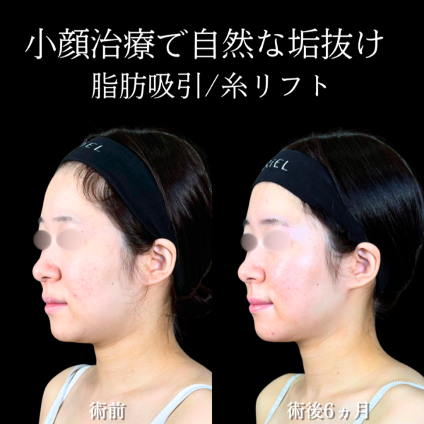 No.20207の症例写真