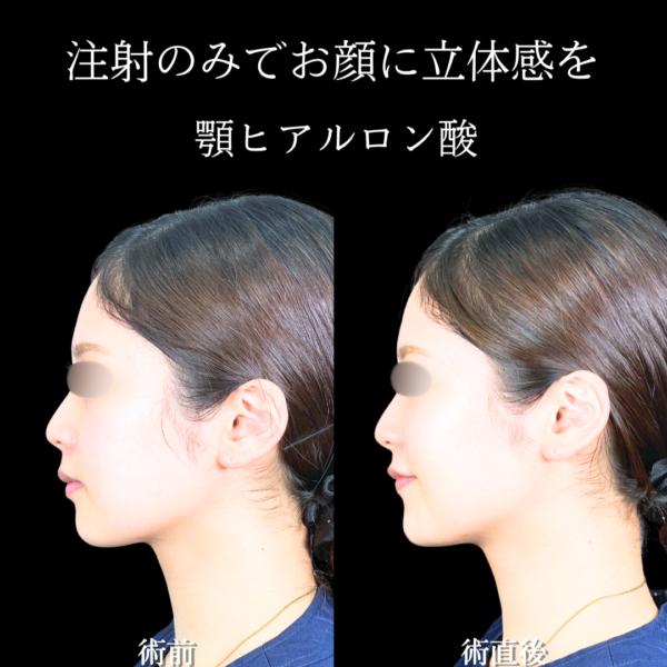 No.20140の症例写真