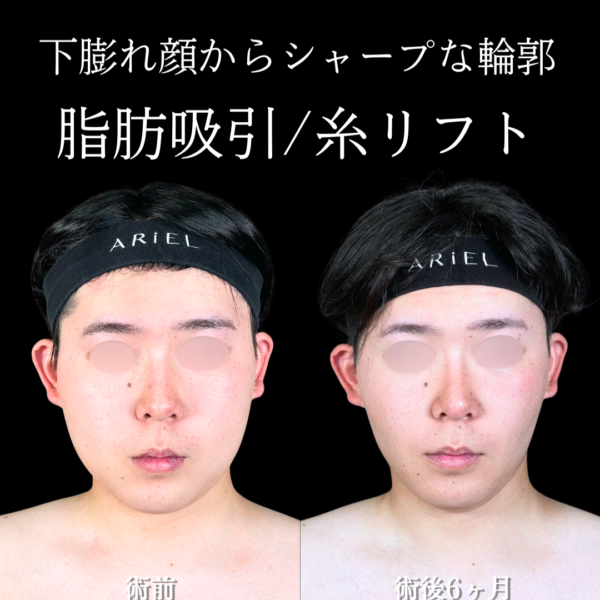 No.20216の症例写真