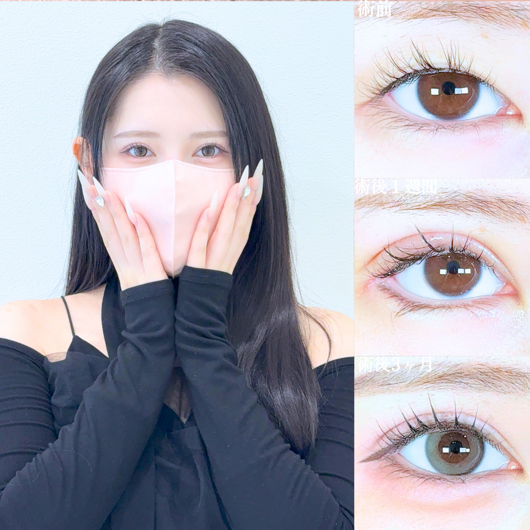 No.20239の症例写真