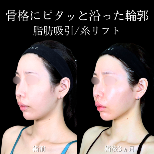 No.20265の症例写真