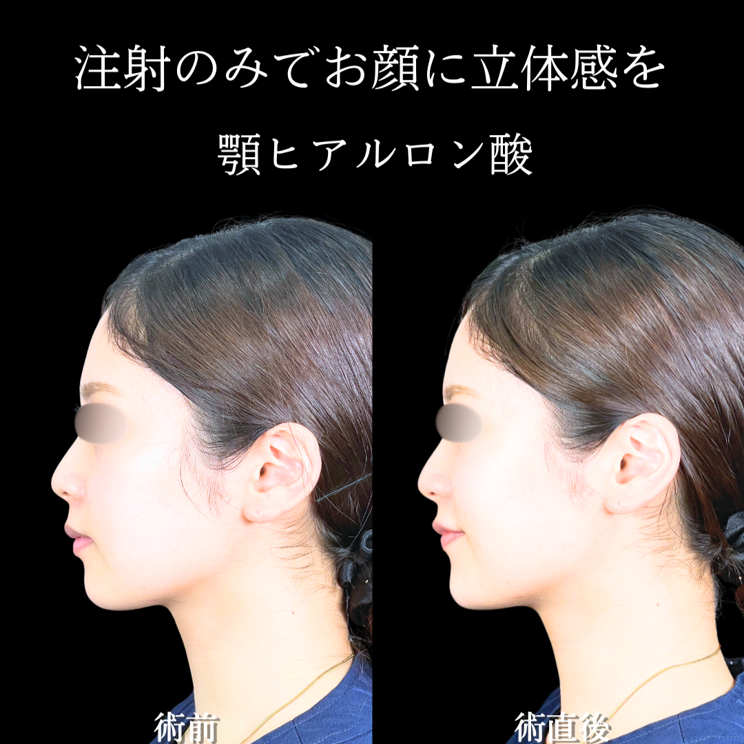 No.20140の症例写真