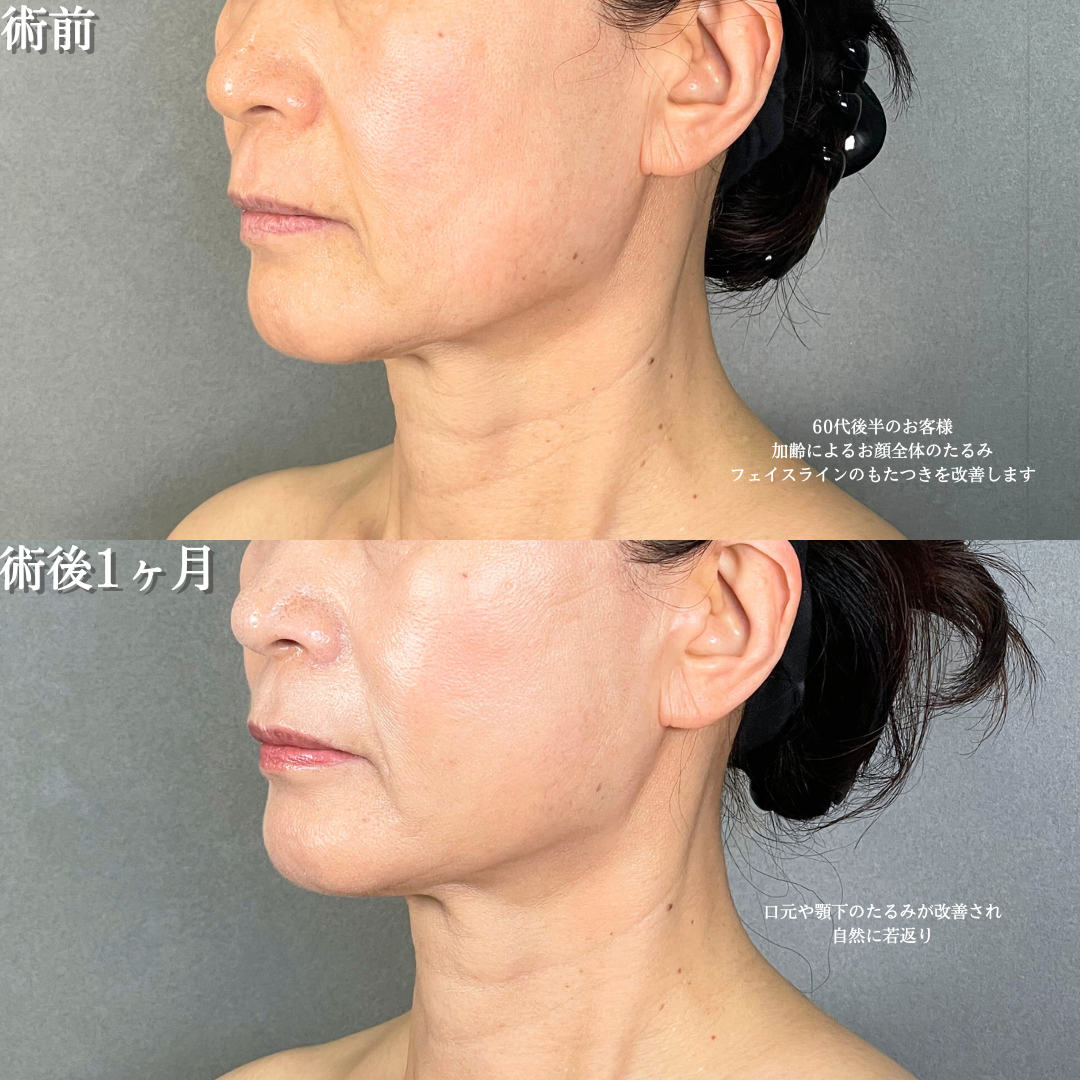 No.20159の症例写真1