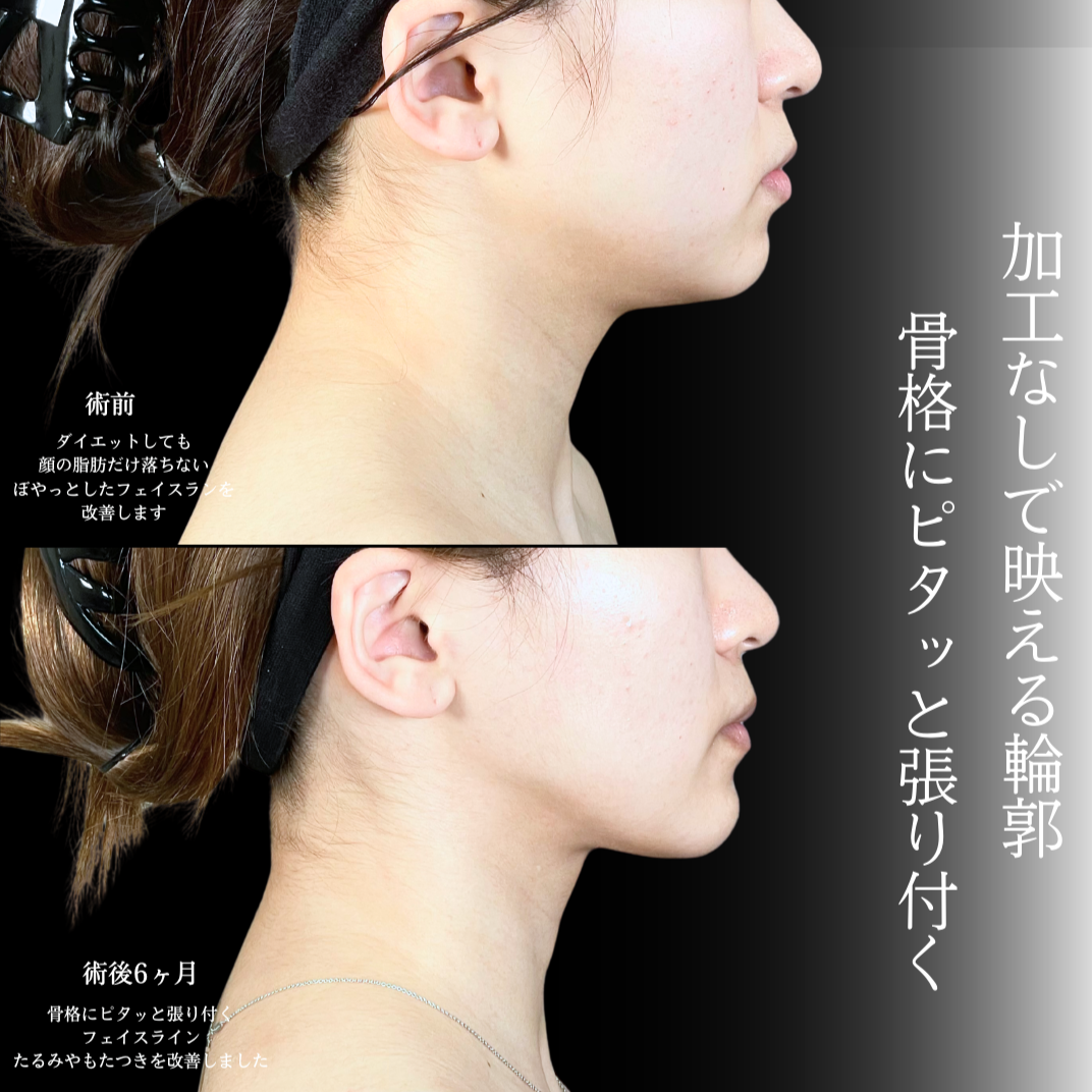 No.20283の症例写真1