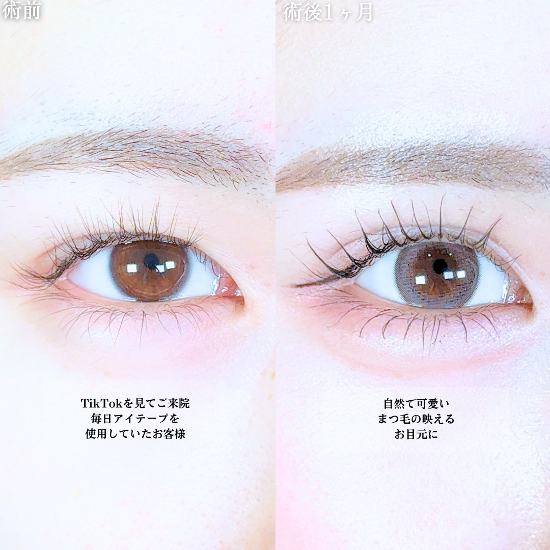 No.20302の症例写真1