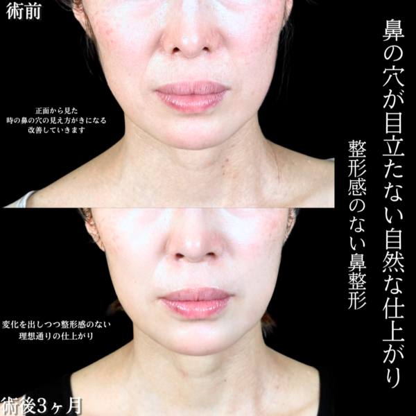 No.20319の症例写真