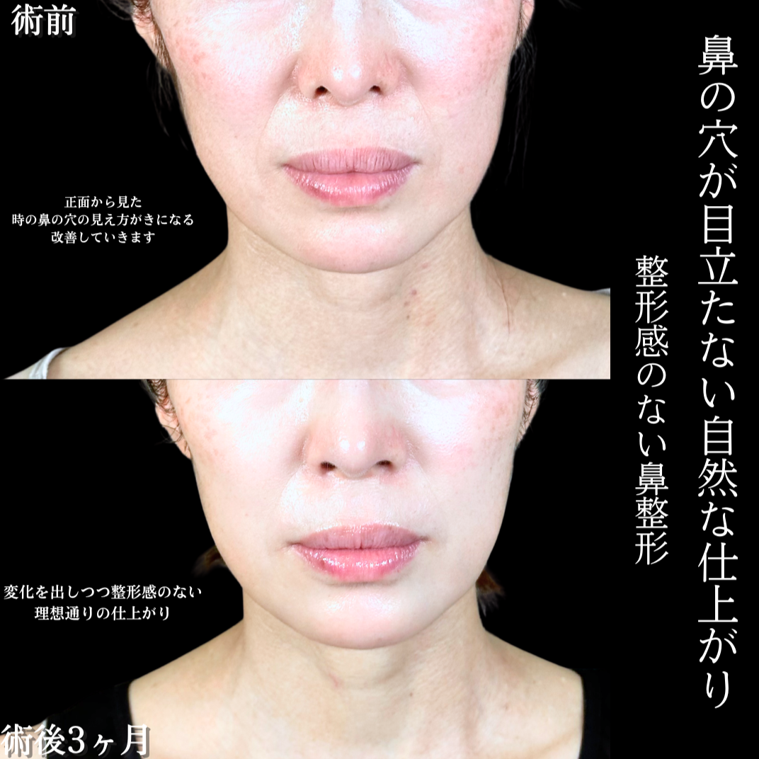 No.20319の症例写真