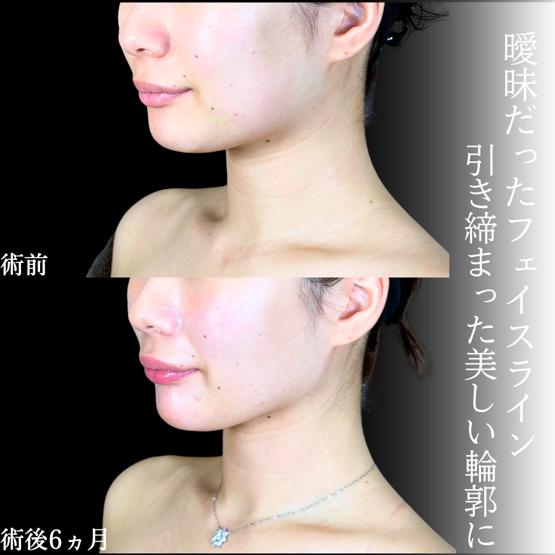 No.20332の症例写真1