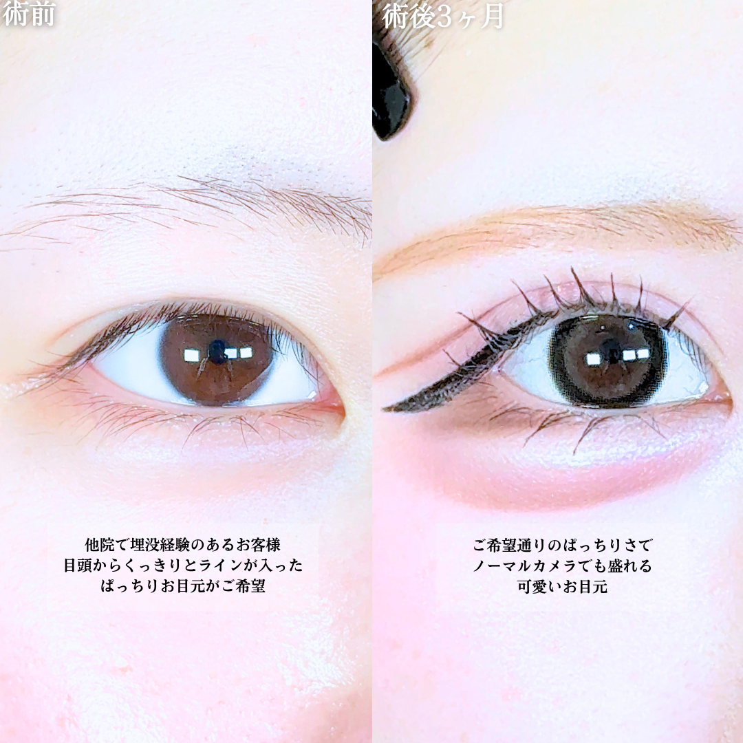 No.20358の症例写真1