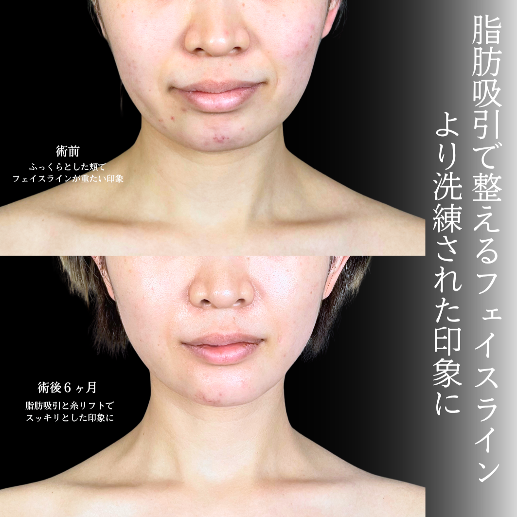 No.20367の症例写真1