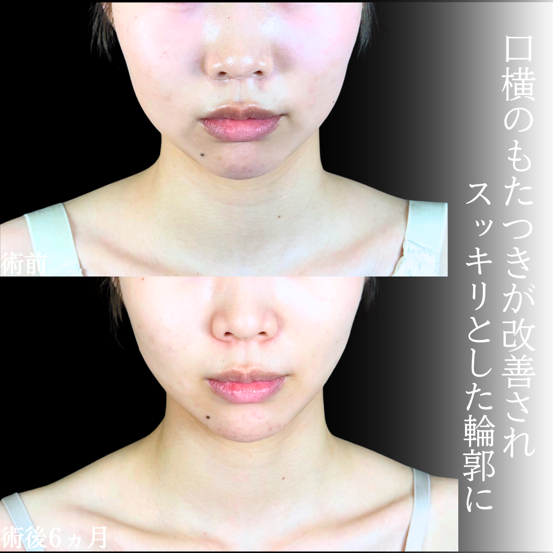 No.20368の症例写真1