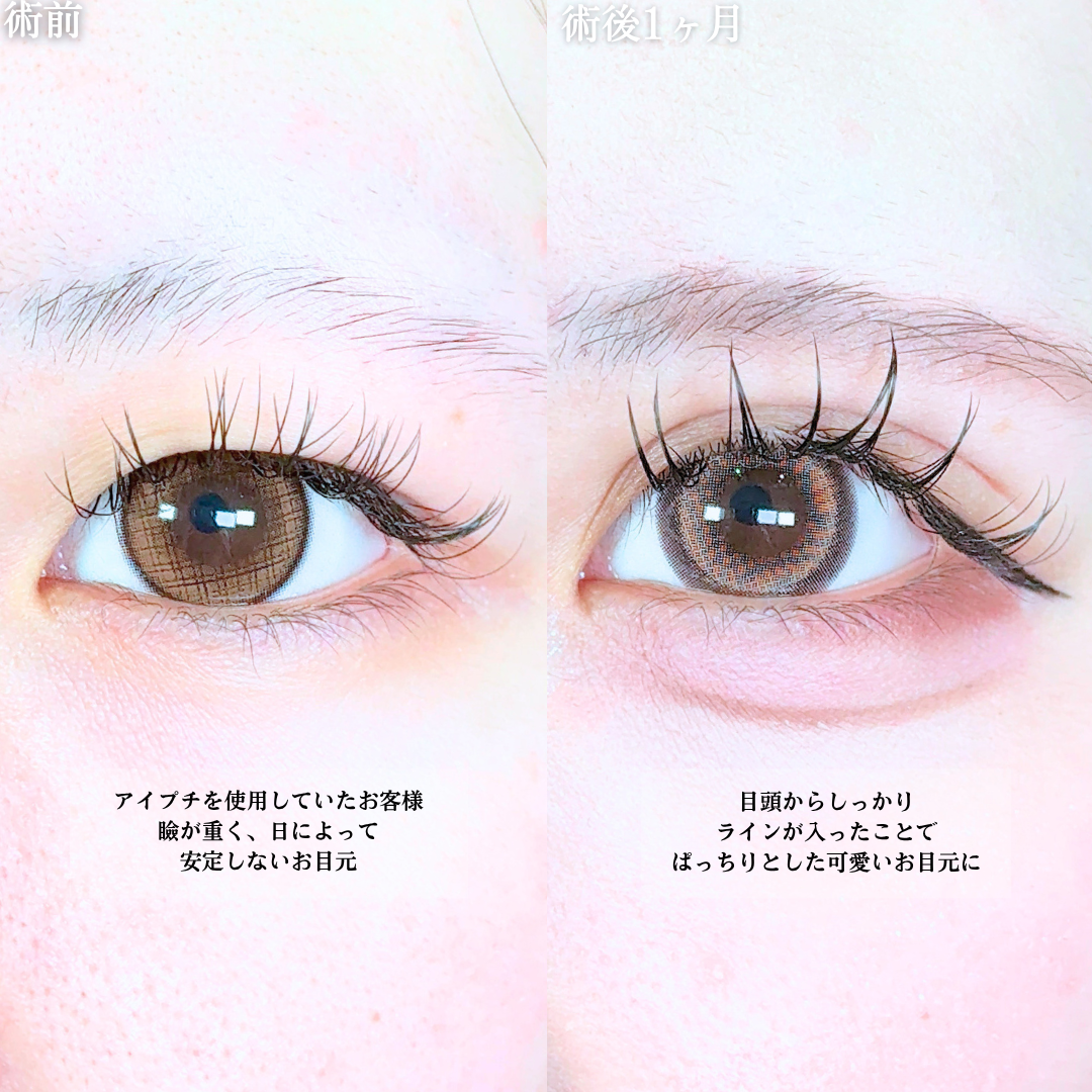 No.20469の症例写真1