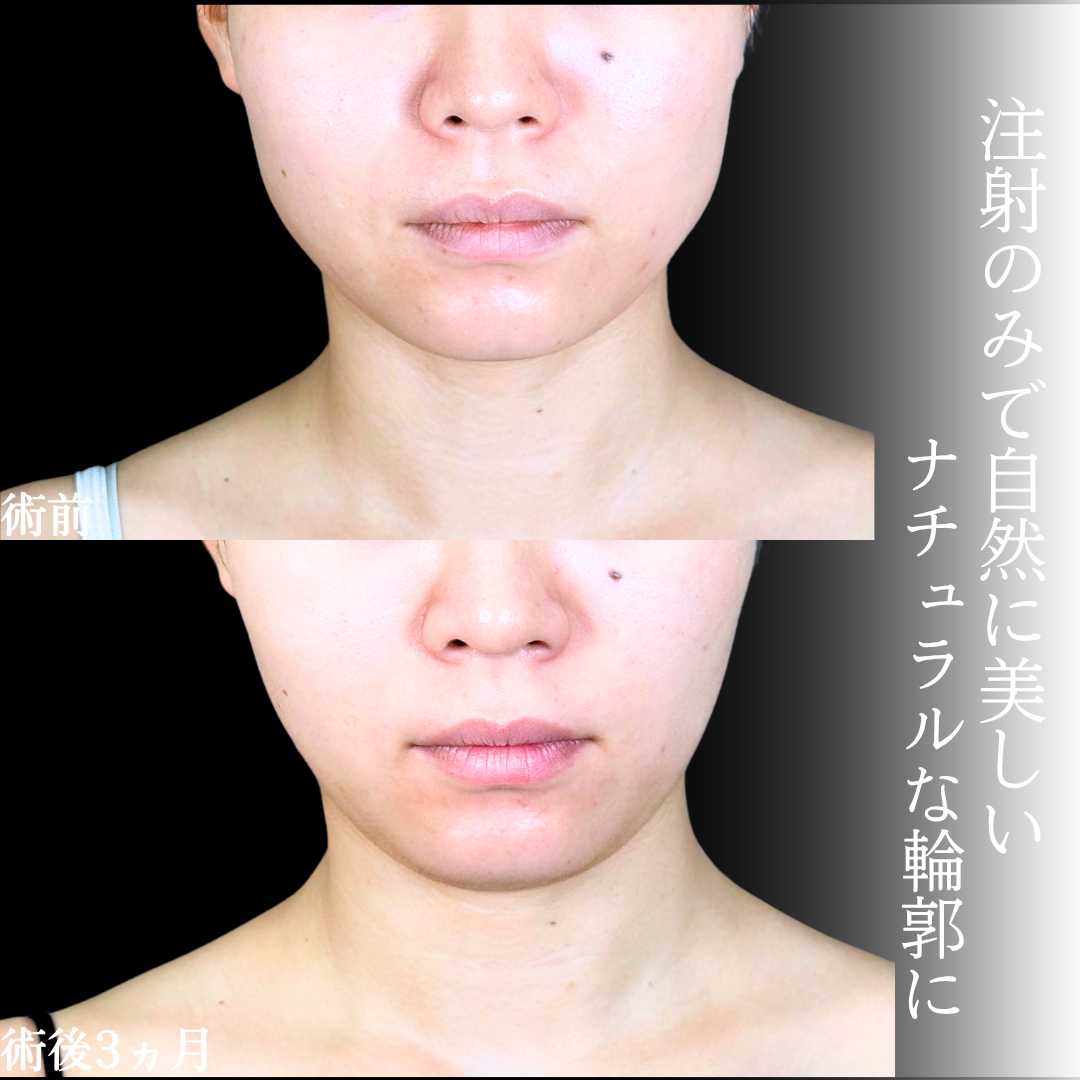 No.20476の症例写真1