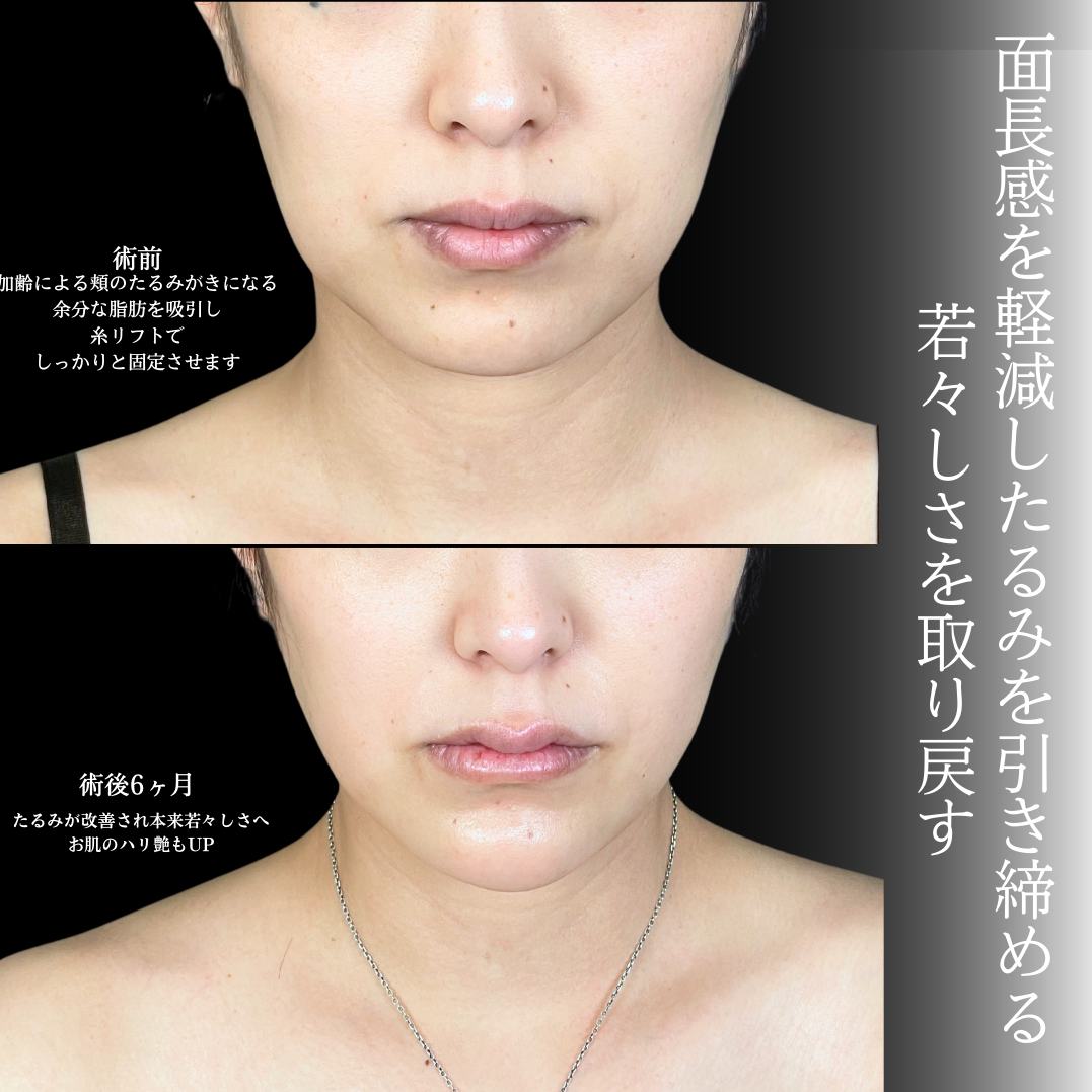 No.20174の症例写真1