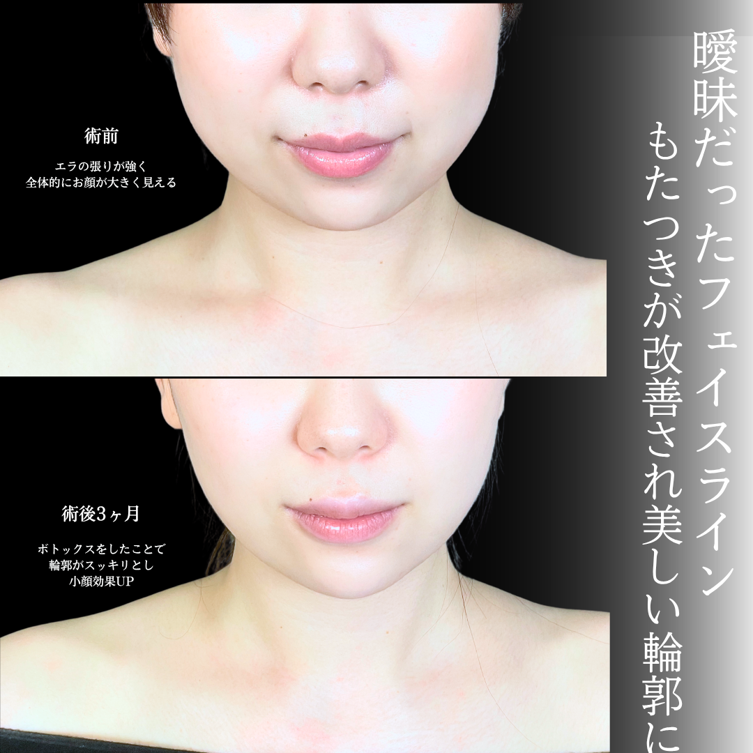 No.20524の症例写真1