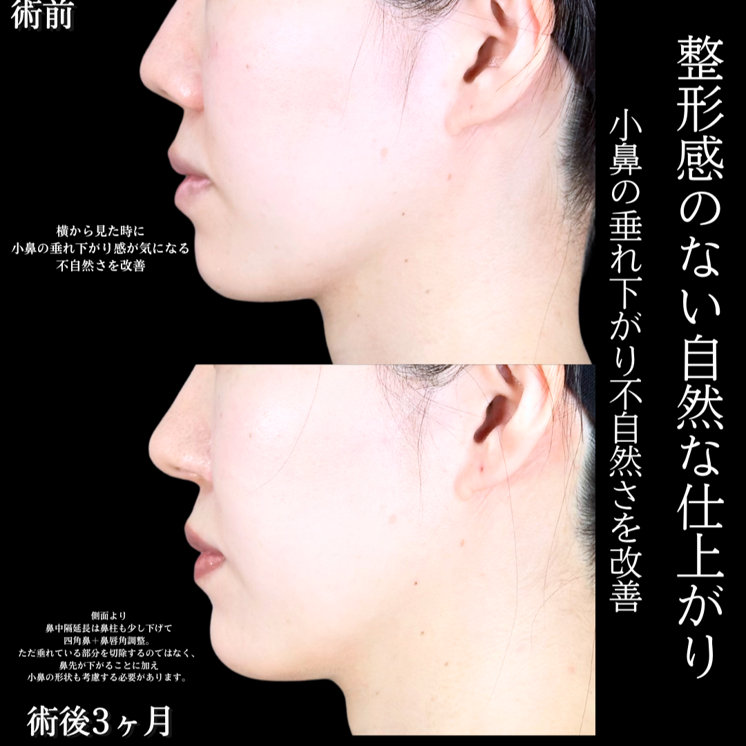 No.20181の症例写真1