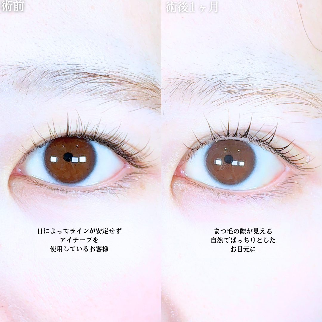 No.20194の症例写真1