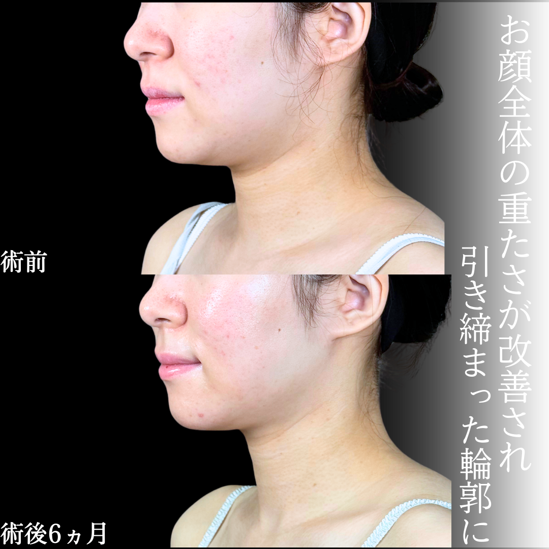 No.20207の症例写真1