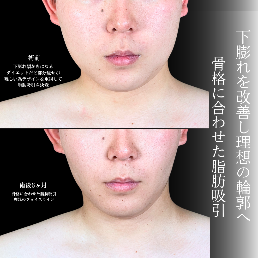 No.20216の症例写真1