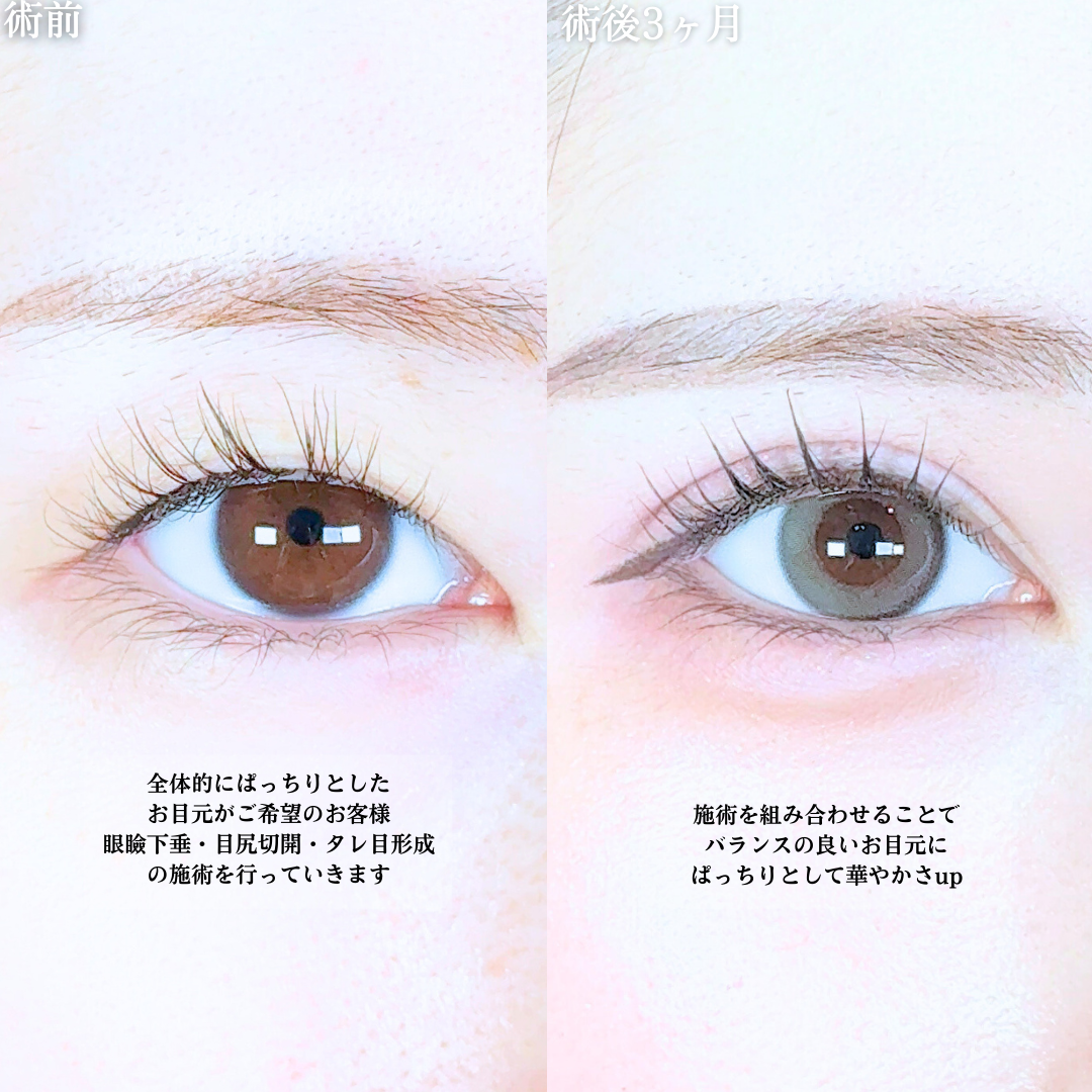 No.20239の症例写真1