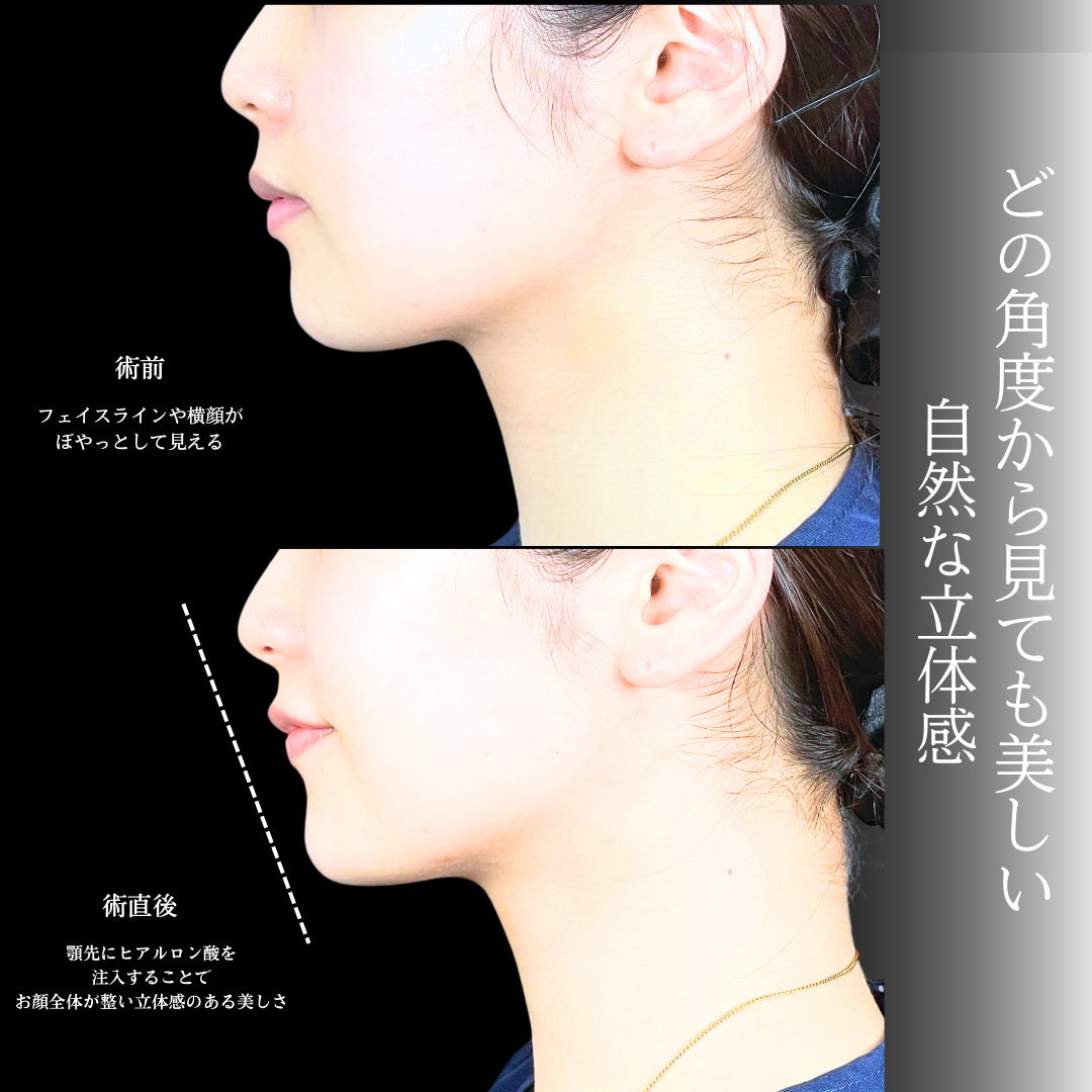 No.20140の症例写真1