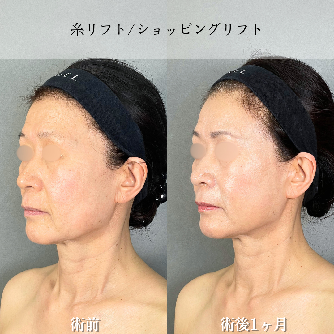 No.20159の症例写真2