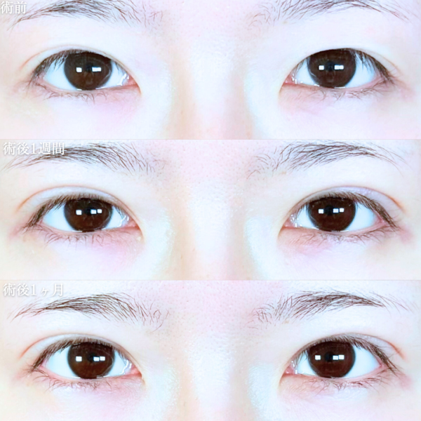 No.20290の症例写真