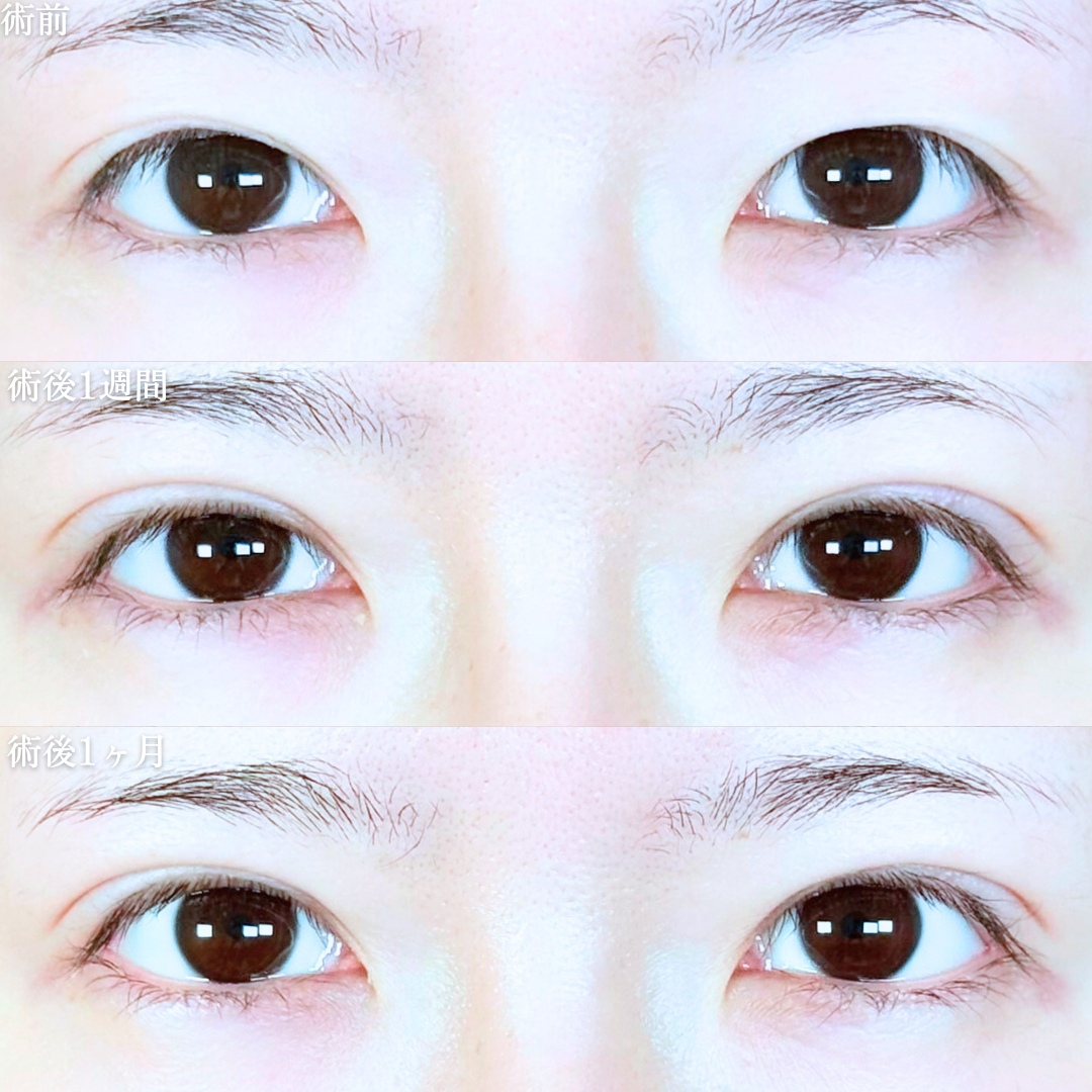 No.20290の症例写真