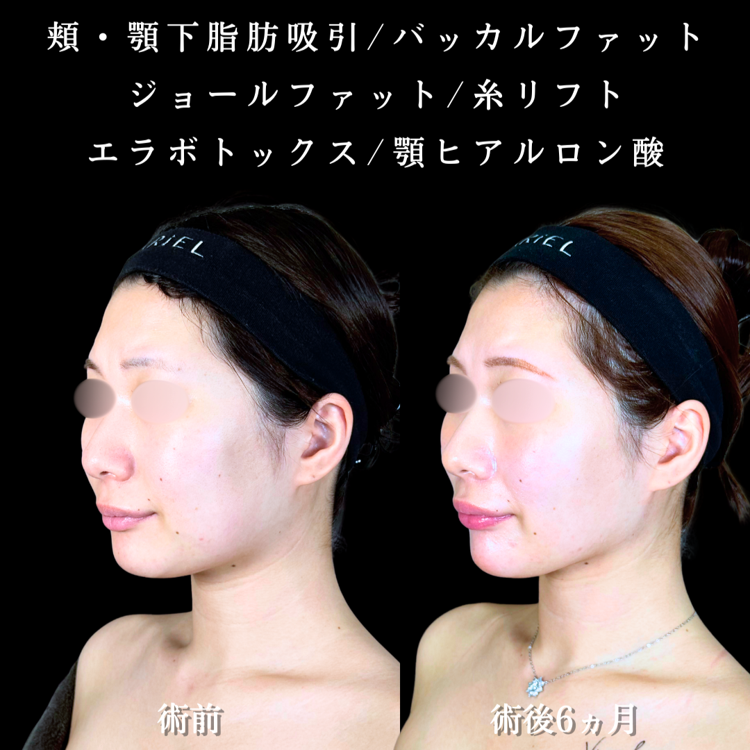 No.20332の症例写真2