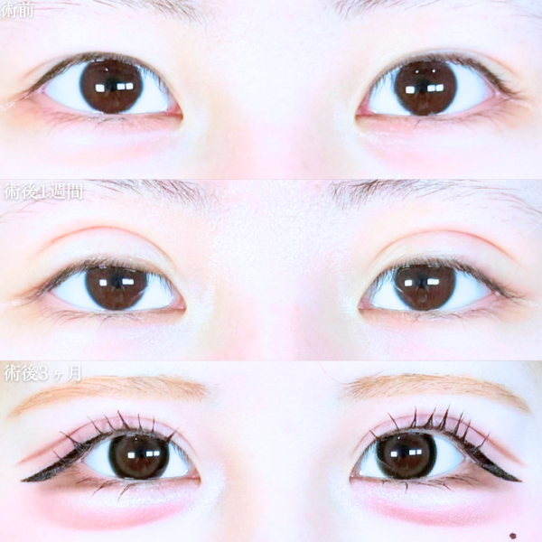 No.20351の症例写真 No.20351の症例写真