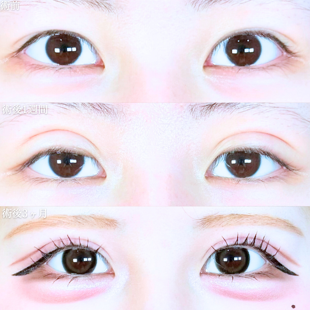 No.20351の症例写真