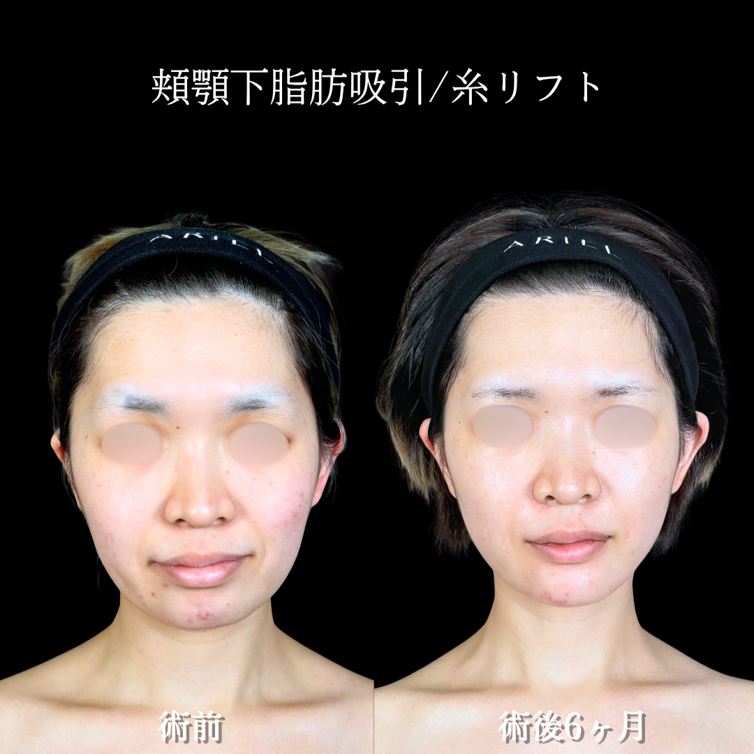 No.20367の症例写真2