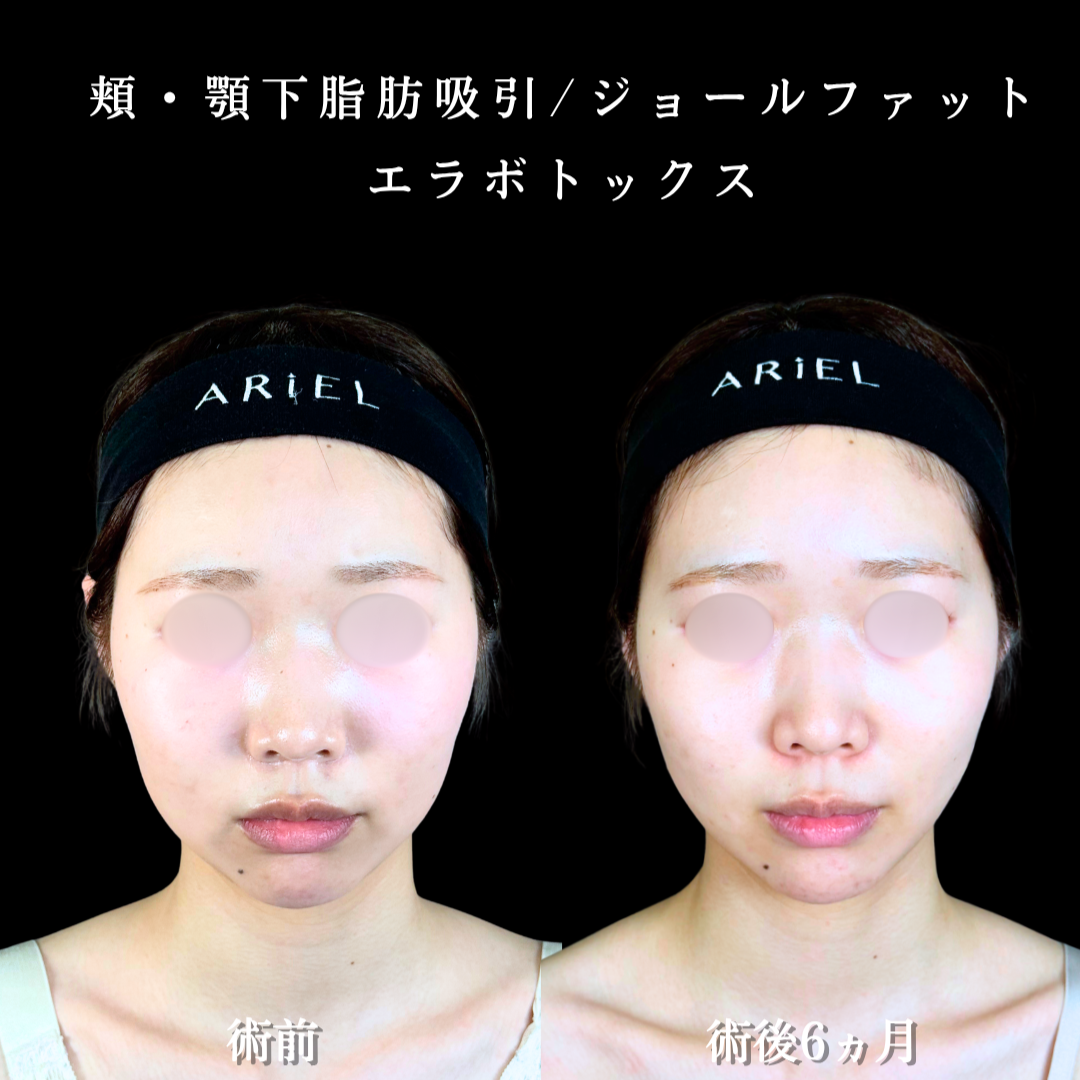 No.20368の症例写真2