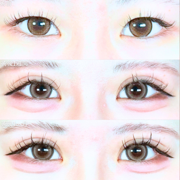 No.20382の症例写真