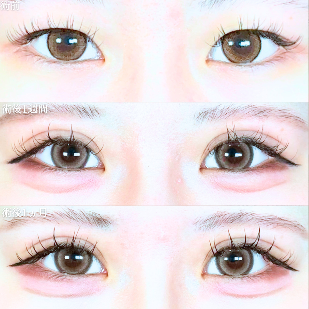 No.20382の症例写真