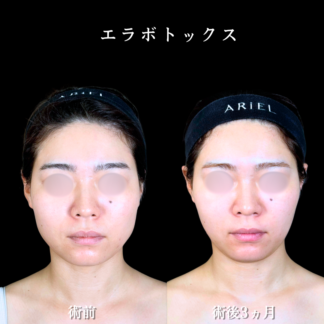 No.20476の症例写真2