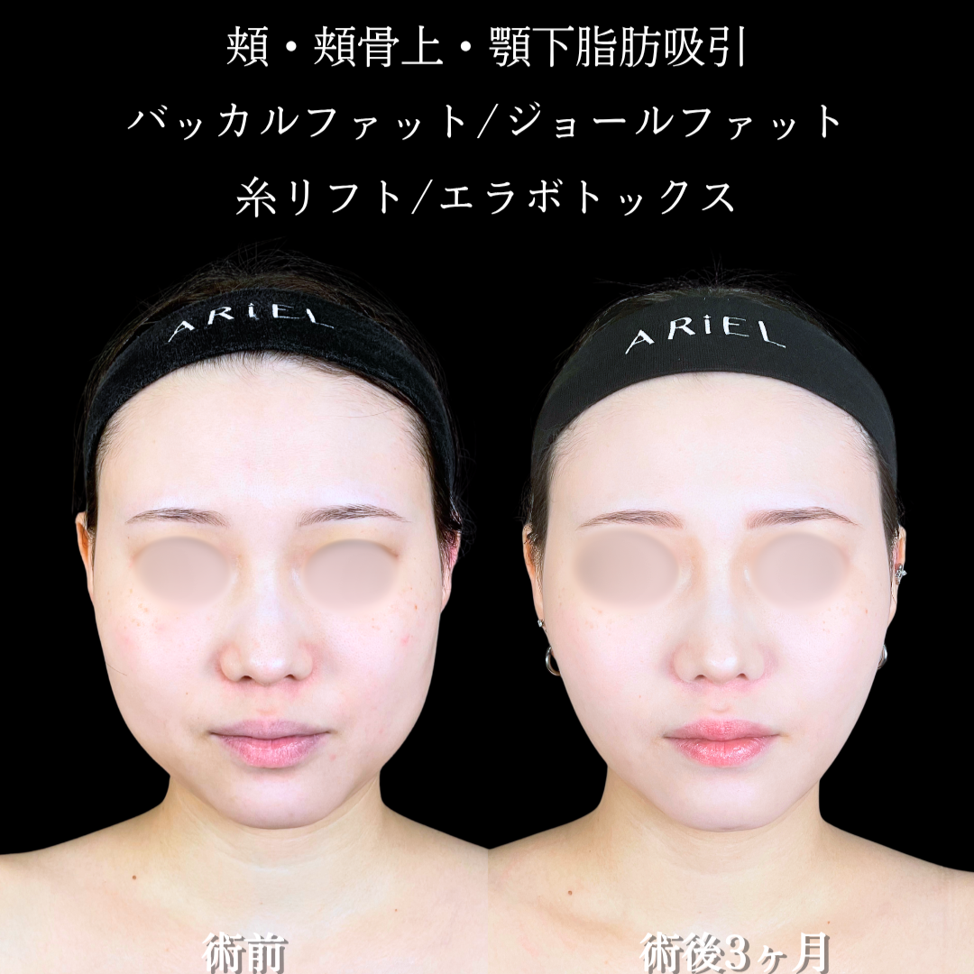 No.20485の症例写真2