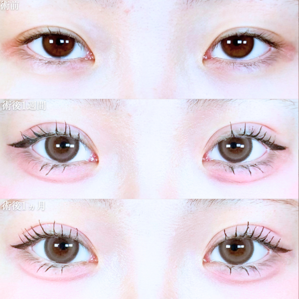 No.20503の症例写真