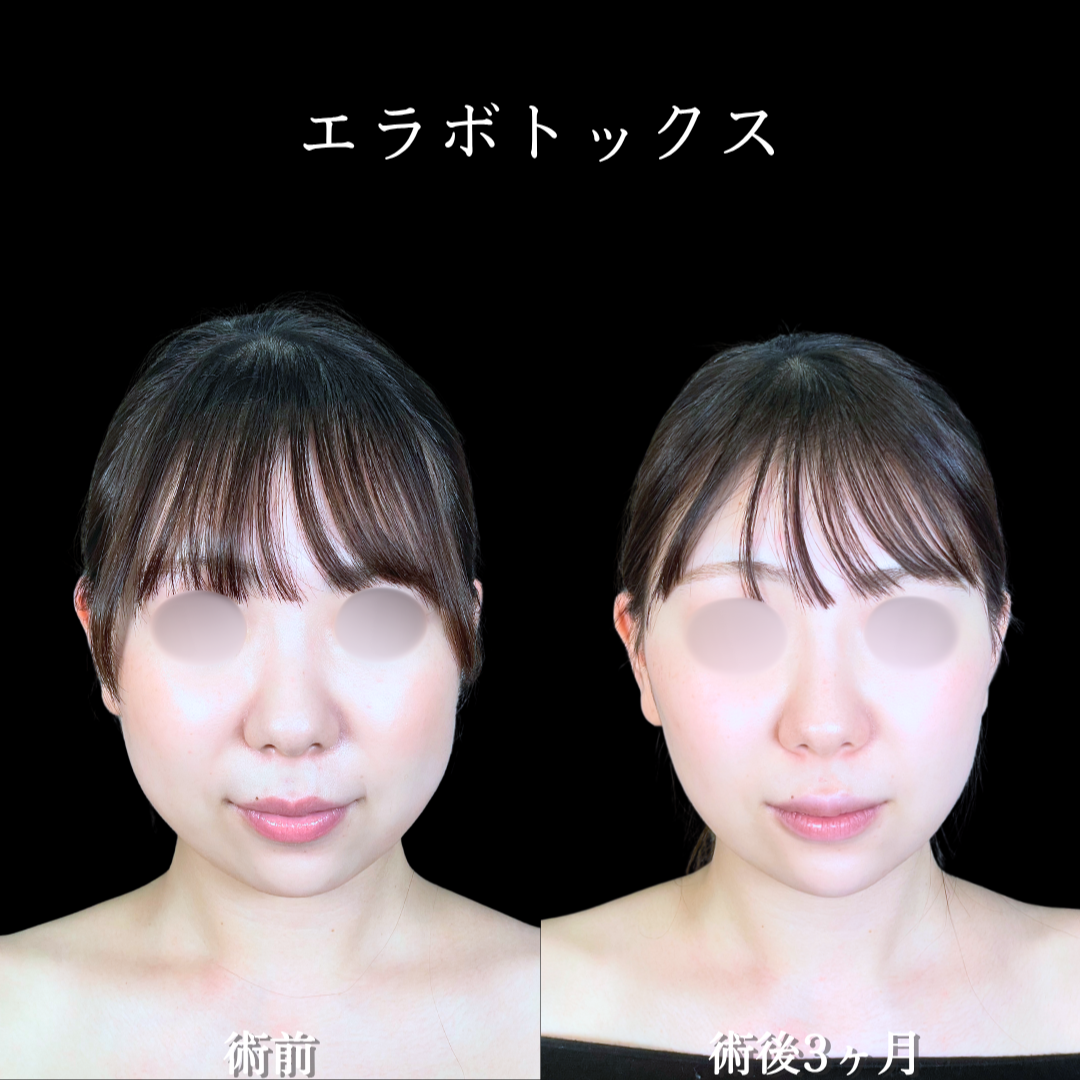 No.20524の症例写真2