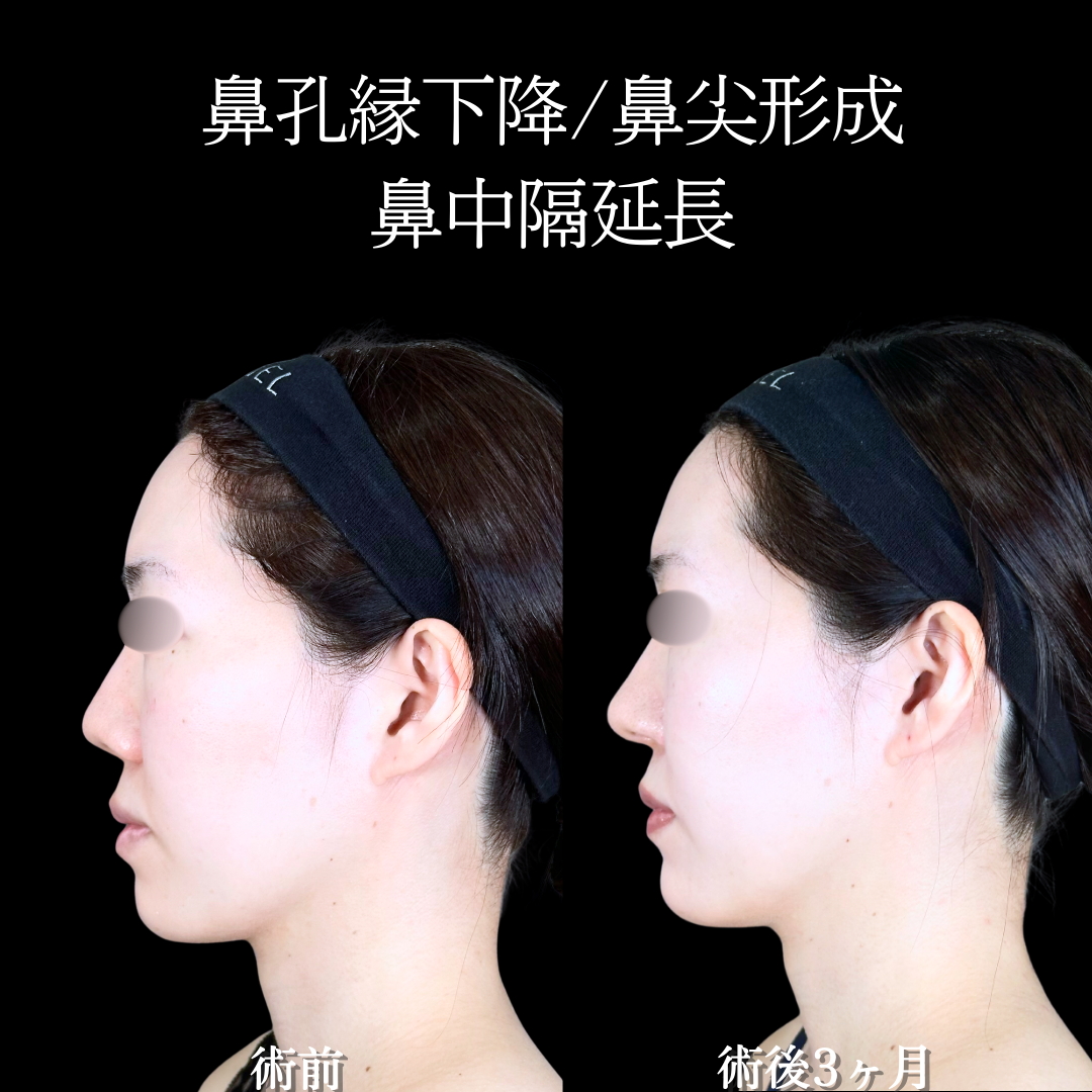 No.20181の症例写真2