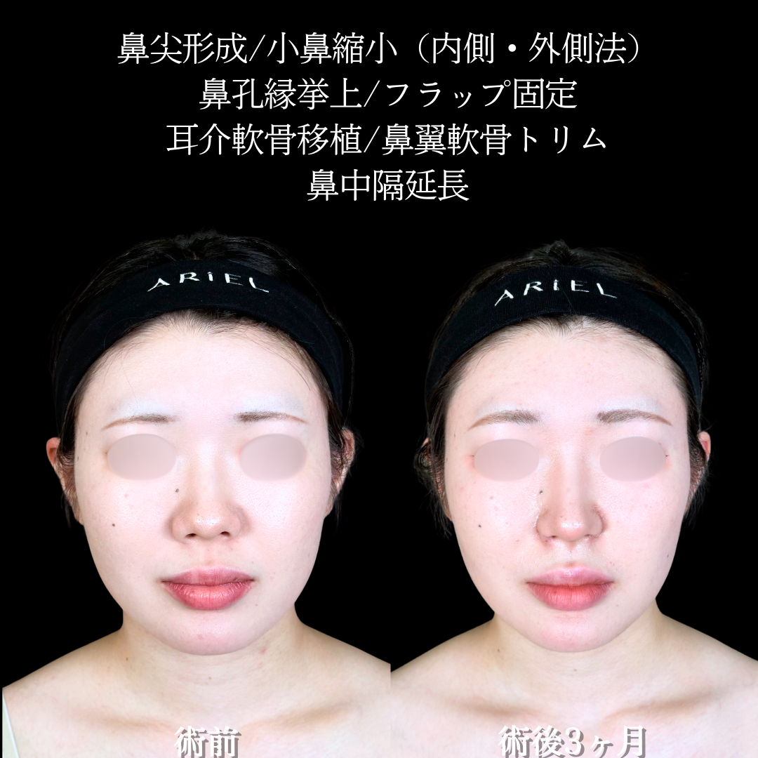 No.20200の症例写真2