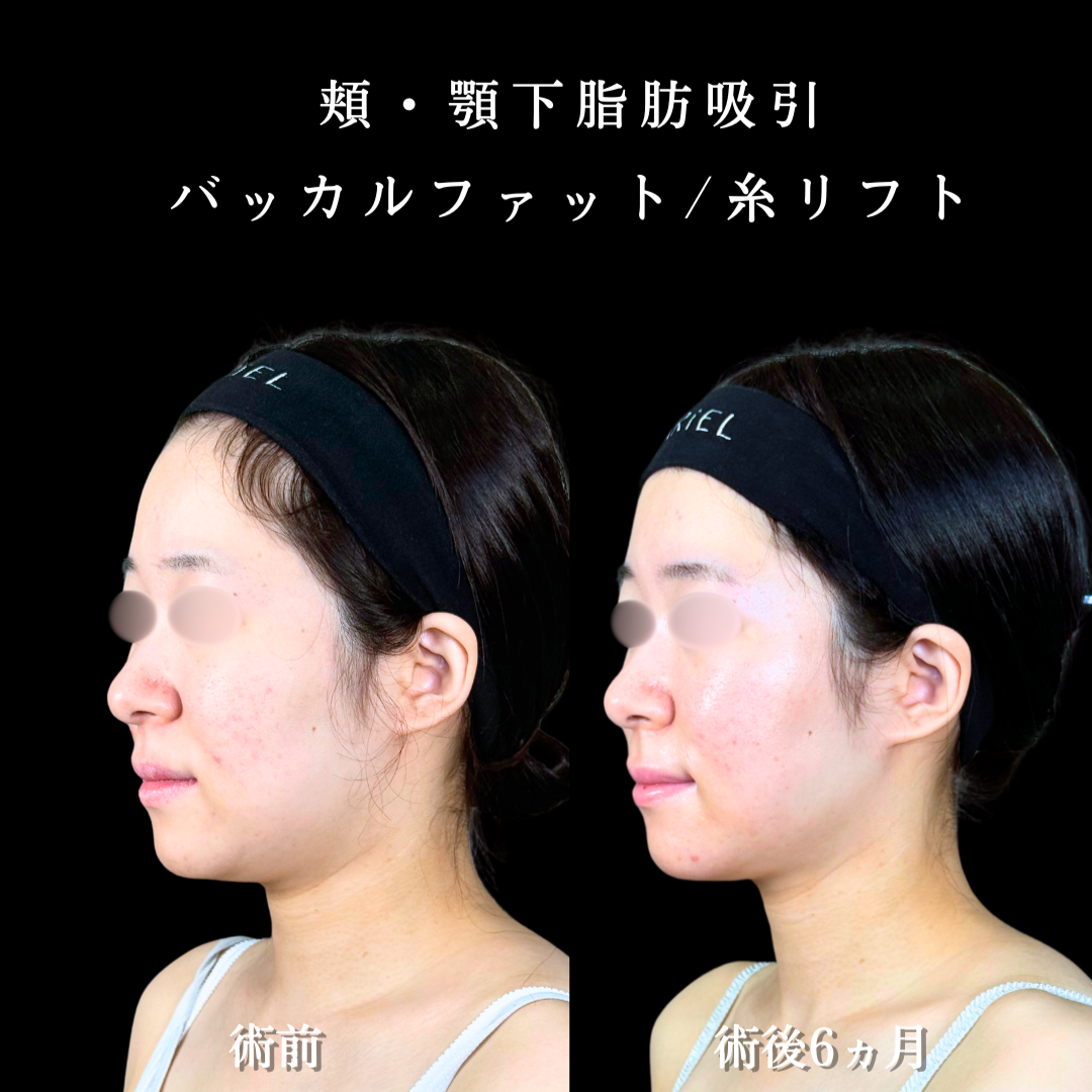 No.20207の症例写真2