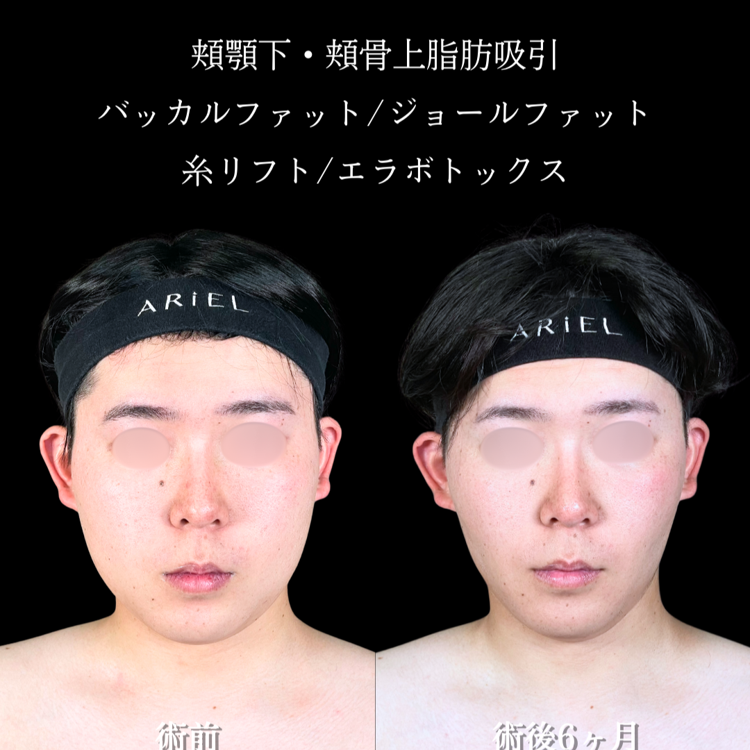 No.20216の症例写真2