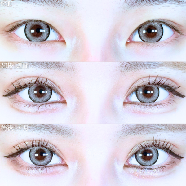 No.20226の症例写真