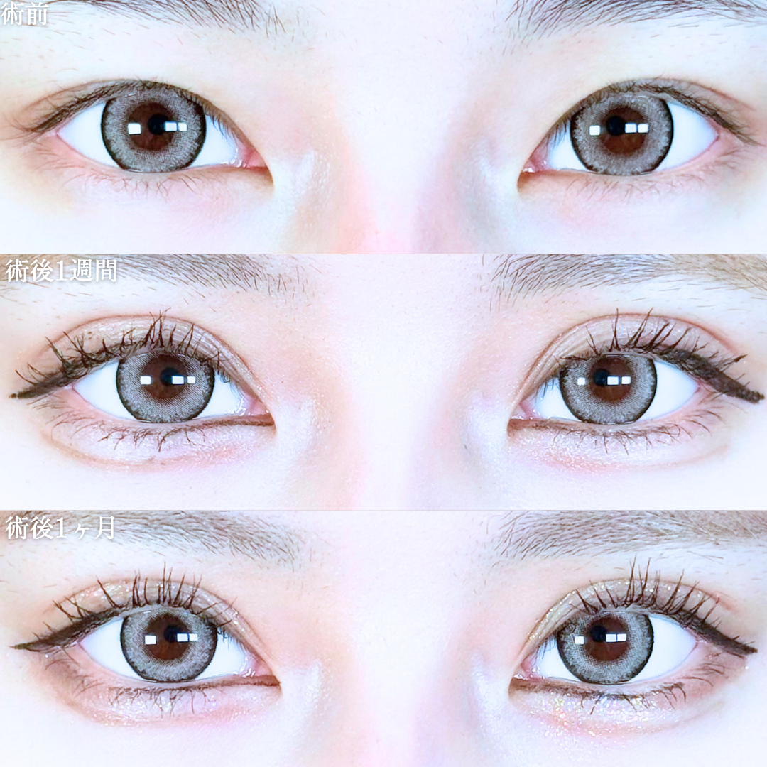 No.20226の症例写真